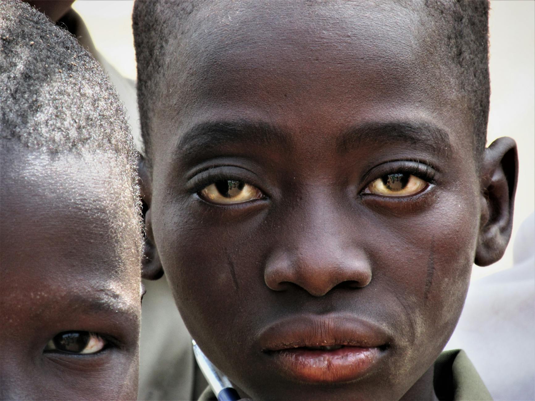Sexuelle Gewalt Sudan Symbolbild zum Thema Sexuelle Gewalt Sudan