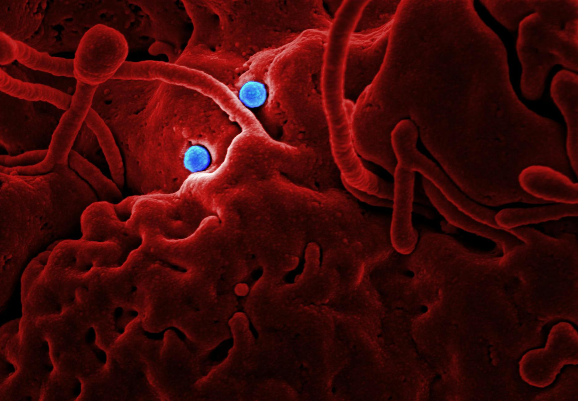 Ebola Ausbruch Detailansicht: Ebola Ausbruch
