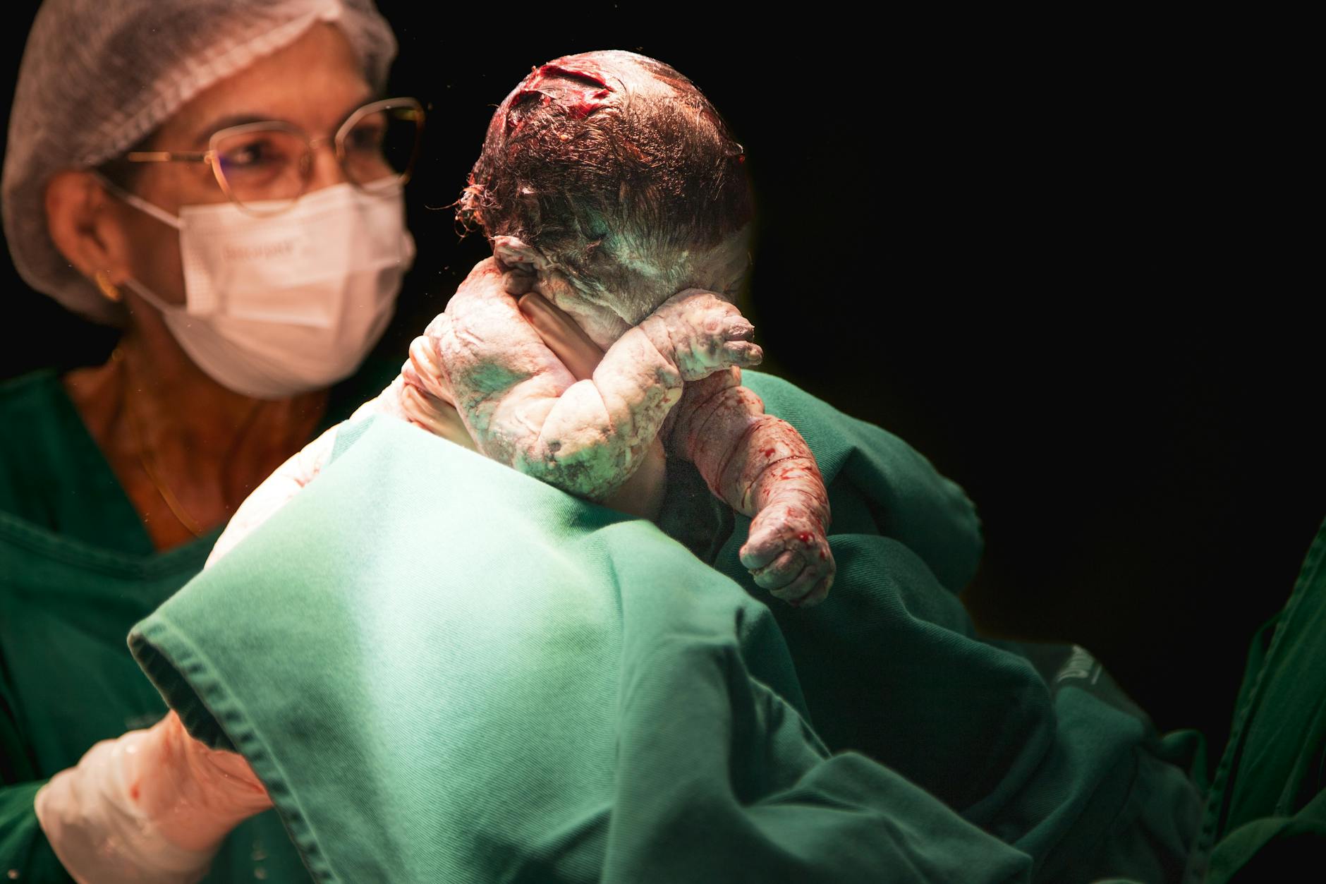 Detailansicht: Vaginale Geburt Nach Kaiserschnitt